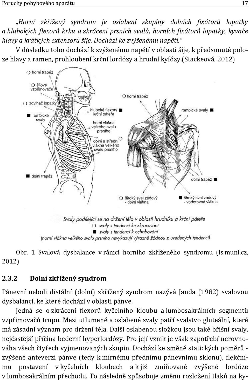 (stackeová, 2012) Obr. 1 Svalová dysbalance v rámci horního zkříženého syndromu (is.muni.cz, 2012) 2.3.