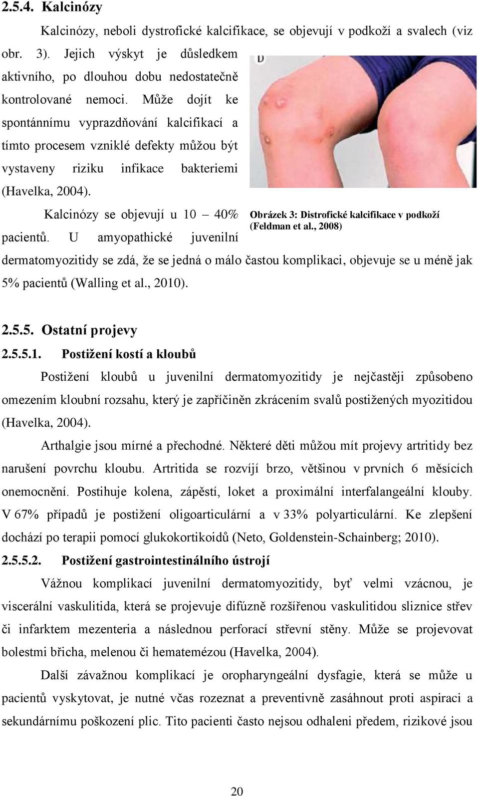 U amyopathické juvenilní dermatomyozitidy se zdá, ţe se jedná o málo častou komplikaci, objevuje se u méně jak 5% pacientů (Walling et al., 2010).