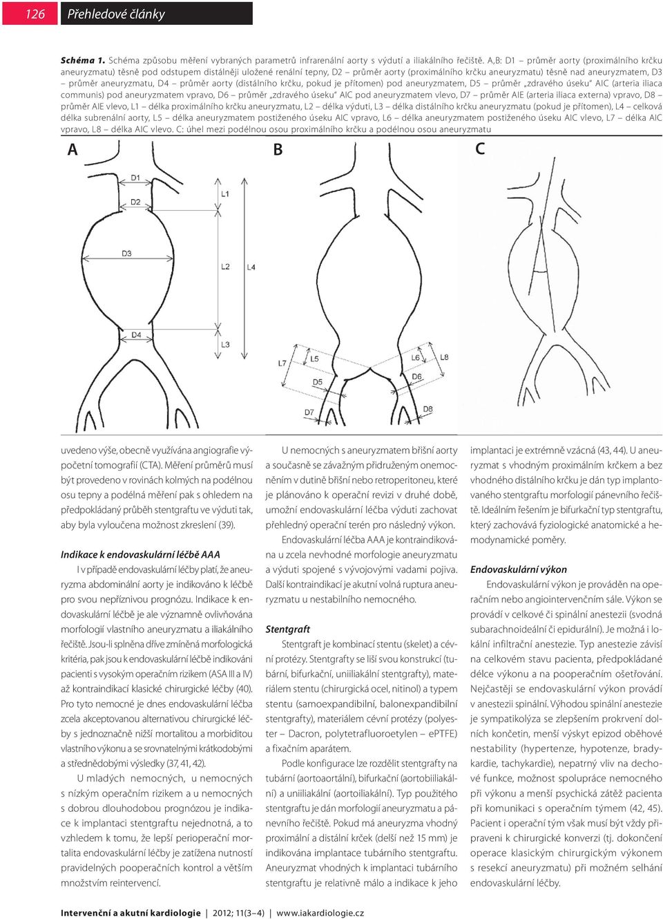 aneuryzmatu, D4 průměr aorty (distálního krčku, pokud je přítomen) pod aneuryzmatem, D5 průměr zdravého úseku AIC (arteria iliaca communis) pod aneuryzmatem vpravo, D6 průměr zdravého úseku AIC pod