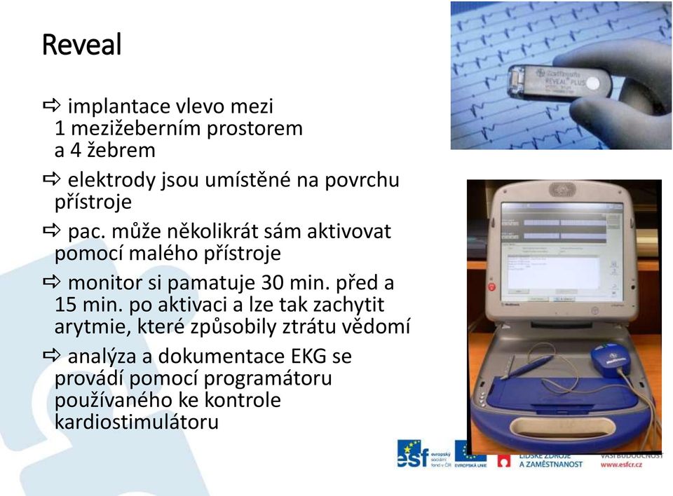 může několikrát sám aktivovat pomocí malého přístroje monitor si pamatuje 30 min.