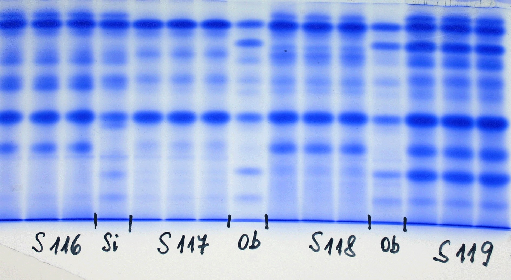 V. Příklady získaných elektroforetických spekter hlízových proteinů Pro ilustraci uvádíme fotografie získaných elektroforetických spekter níže uvedených registrovaných odrůd brambor a některých