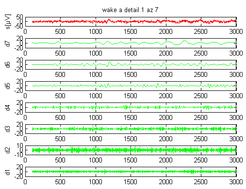 Obrázek 28 Obrázek 29 Detail signálu ve fázi wake V dalším kroku v programu Matlab byla použita vlnková paketová metoda, jež je zobecněním vlnkové dekompozice.