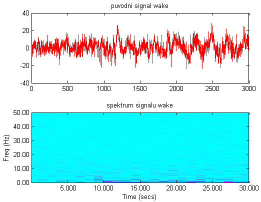 Obrázek 30 Dekompozice signálů pomocí WPT pro uzel 36 alfa Dále bylo vykresleno vlnkové paketové spektrum pro jednotlivé fáze spánku, které obsahují na vertikální ose obsažené frekvence a na