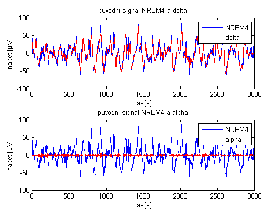 Obrázek 40 Koeficienty jednotlivých pásem pro fázi NREM1 Též bylo znázorněno amplitudové spektrum jednotlivých pásem pro ověření zda jejich spektrální složení opravdu obsahuje dané pásmo např.