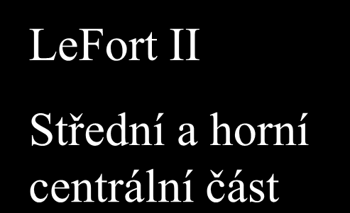 LeFort II Střední
