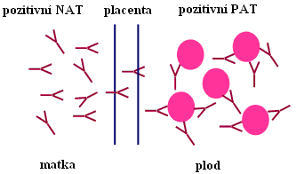 4 Komplikace způsobené nepravidelnými antierytrocytárními protilátkami Nepravidelné antierytrocytární protilátky jsou zodpovědné za řadu imunitních hemolytických stavů.