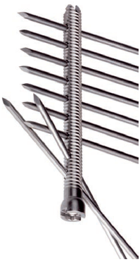 BULLETIN OF APPLIED MECHANICS 6(24), 66-70 (2010) 66 Biomechanical analyses of distal radius osteosynthesis Zdeněk Horák, Martin Vlček, Ivan Landor Abstract In case of complicated distal radius