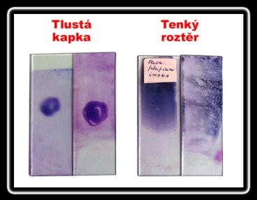 V diagnostice krevních parazitů je důleţité provedení