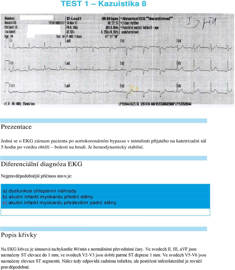 Diferenciální diagnóza EKG Nejpravděpodobnější příčinou stavu je: a) dysfunkce chlopenní náhrady b) akutní infarkt myokardu přední stěny c) akutní infarkt myokardu především zadní