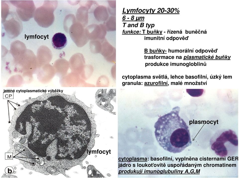 cytoplasma světlá, lehce basofilní, úzký lem granula: azurofilní, malé množství plasmocyt lymfocyt