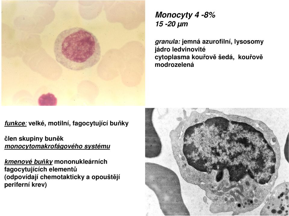 fagocytující buňky člen skupiny buněk monocytomakrofágového systému kmenové