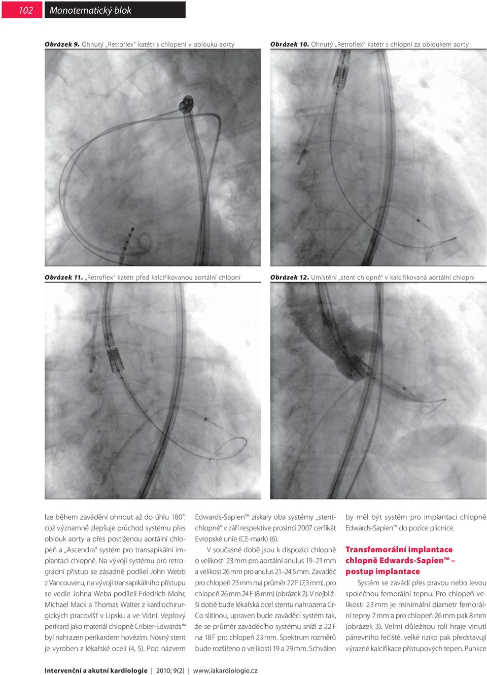 Umístění stent chlopně v kalcifikovaná aortální chlopni lze během zavádění ohnout až do úhlu 180, což významně zlepšuje průchod systému přes oblouk aorty a přes postiženou aortální chlopeň a Ascendra