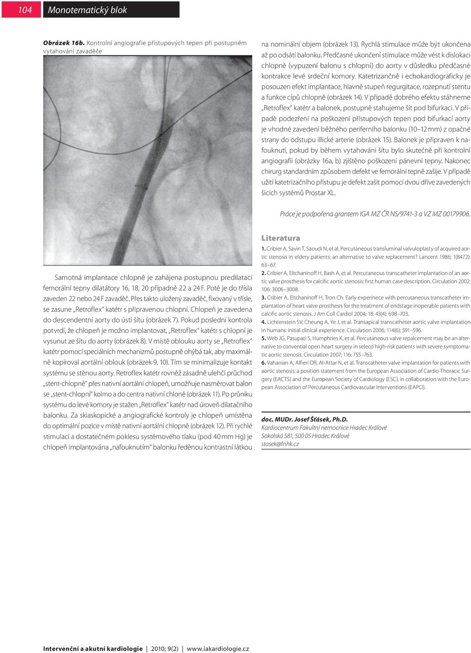 Katetrizančně i echokardiograficky je posouzen efekt implantace, hlavně stupeň regurgitace, rozepnutí stentu a funkce cípů chlopně (obrázek 14).