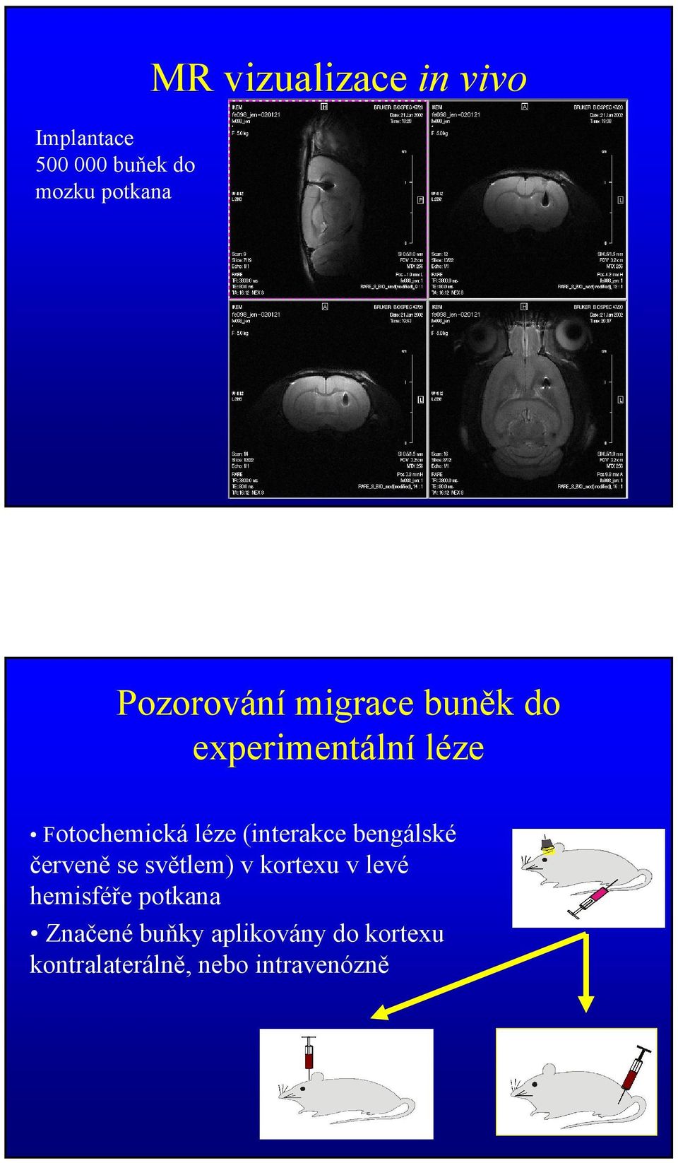 (interakce bengálské červeně se světlem) v kortexu v levé hemisféře