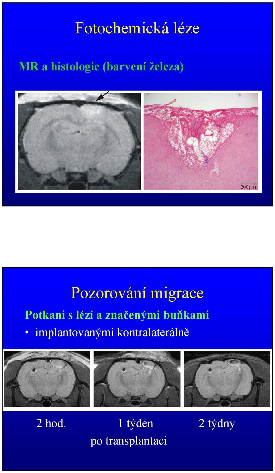 lézí a značenými buňkami implantovanými