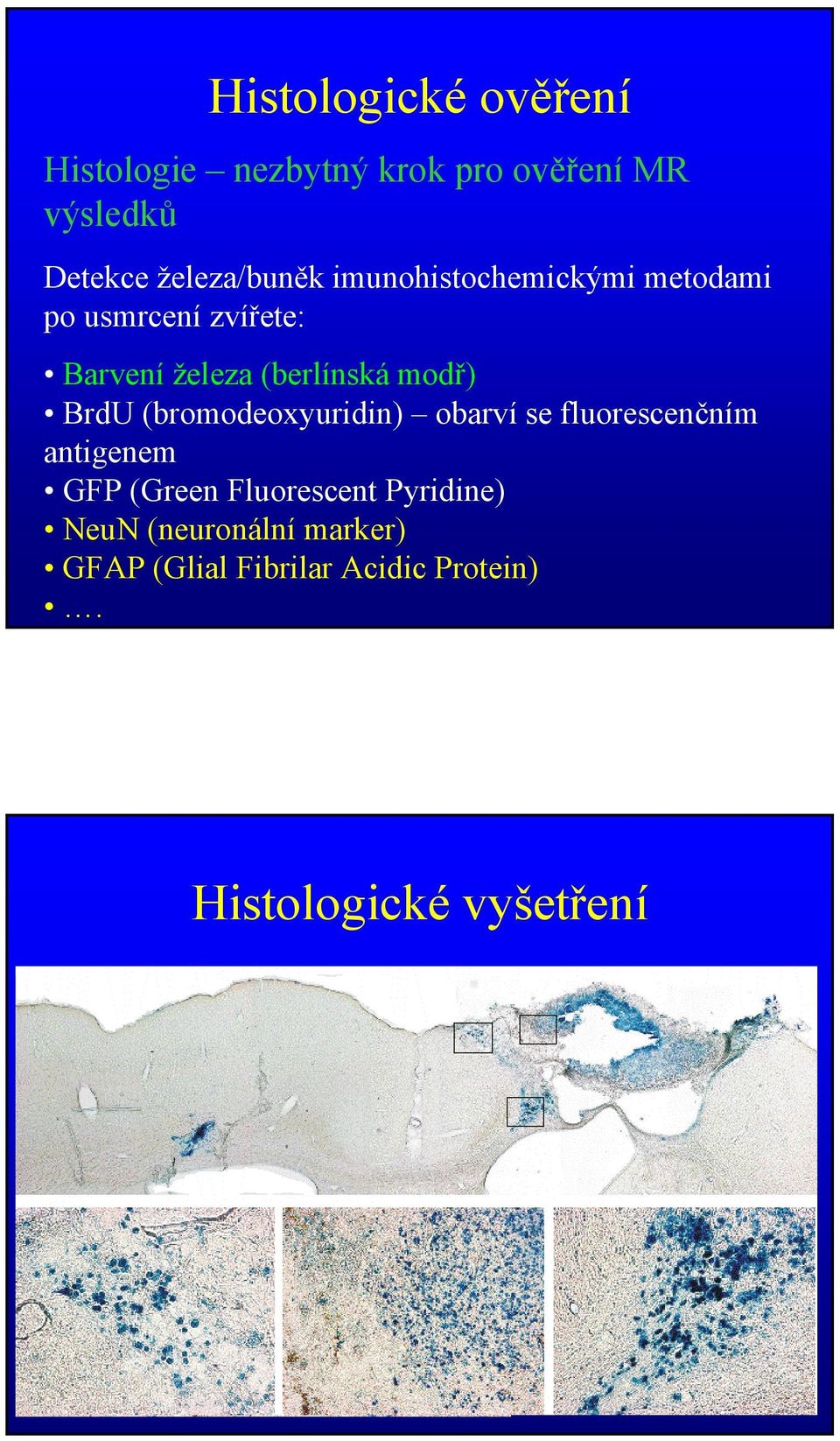 (berlínská modř) BrdU (bromodeoxyuridin) obarví se fluorescenčním antigenem GFP (Green