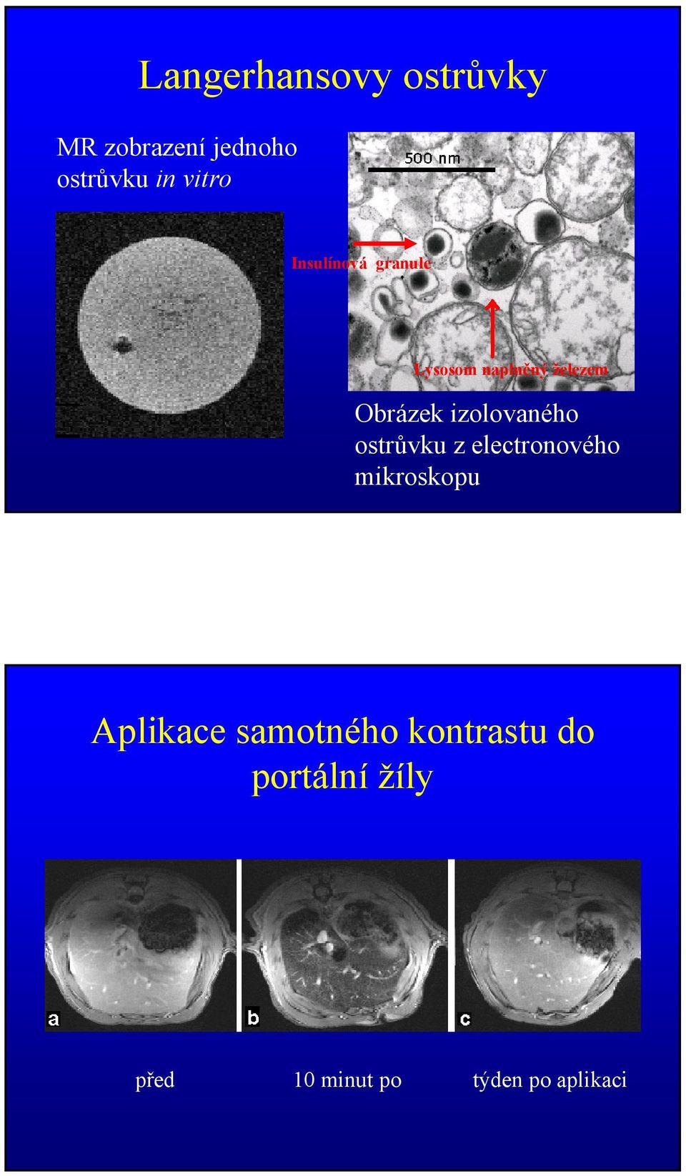 izolovaného ostrůvku z electronového mikroskopu Aplikace