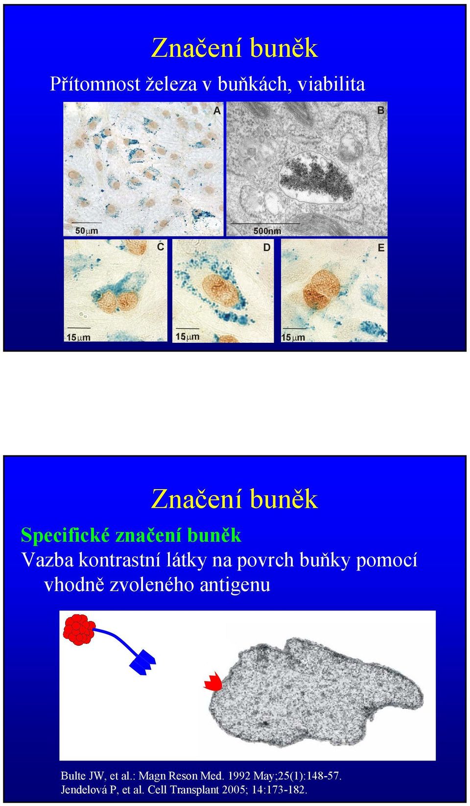 povrch buňky pomocí vhodně zvoleného antigenu Bulte JW, et al.: Magn Reson Med.