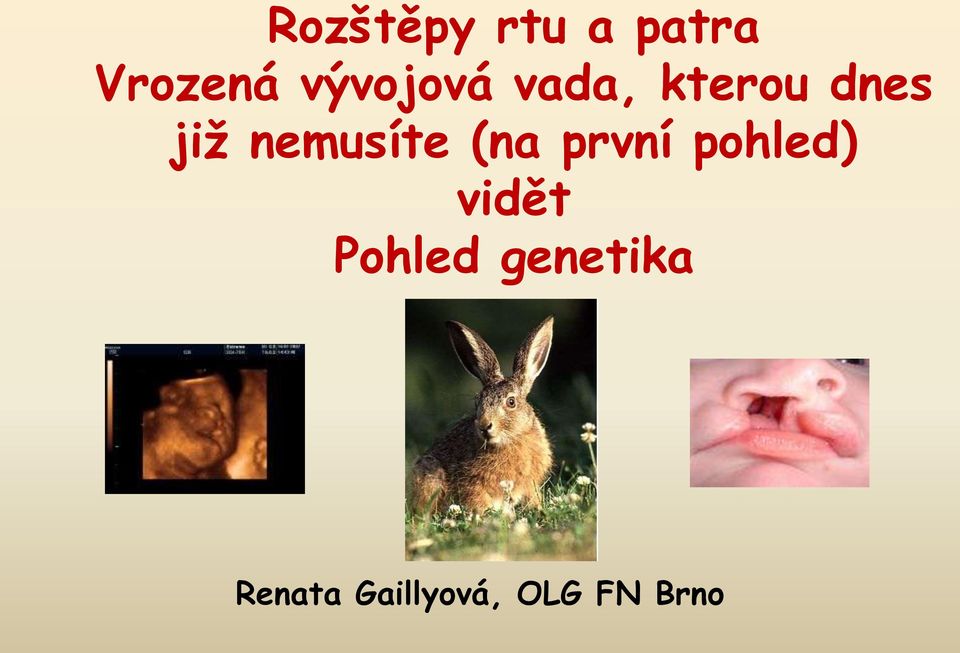 nemusíte (na první pohled) vidět