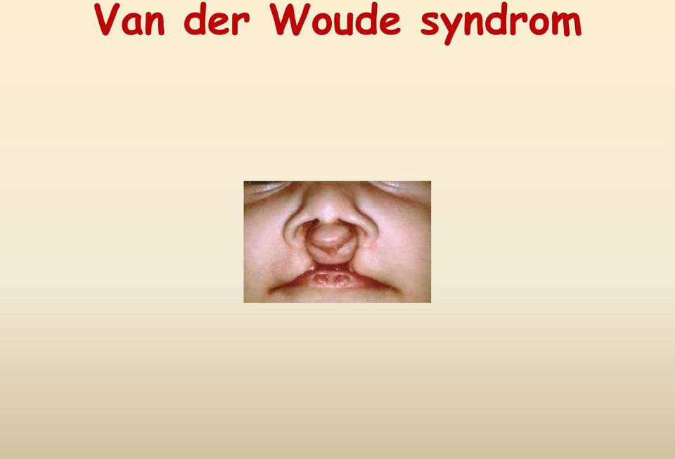 syndrom