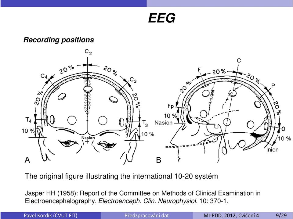 10-20 systém Jasper HH (1958): Report of the Committee on Methods of