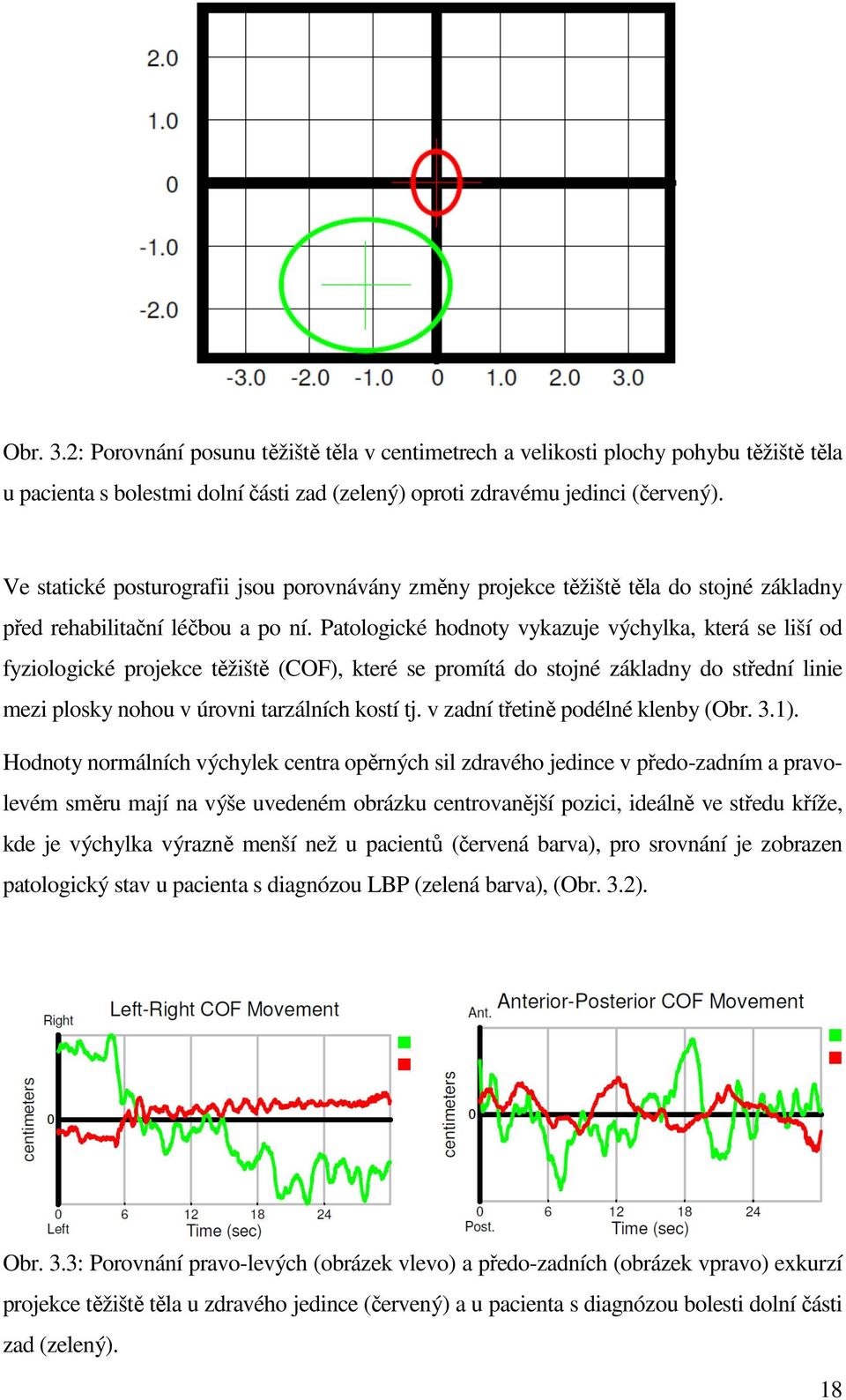Patologické hodnoty vykazuje výchylka, která se liší od fyziologické projekce těžiště (COF), které se promítá do stojné základny do střední linie mezi plosky nohou v úrovni tarzálních kostí tj.