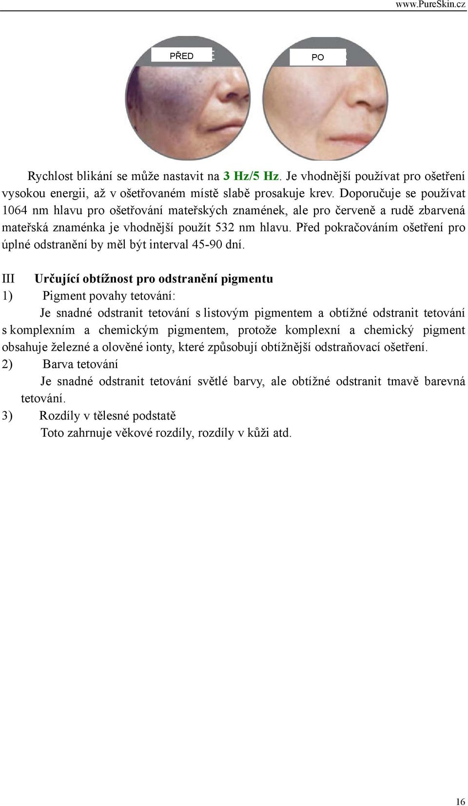 Před pokračováním ošetření pro úplné odstranění by měl být interval 45-90 dní.