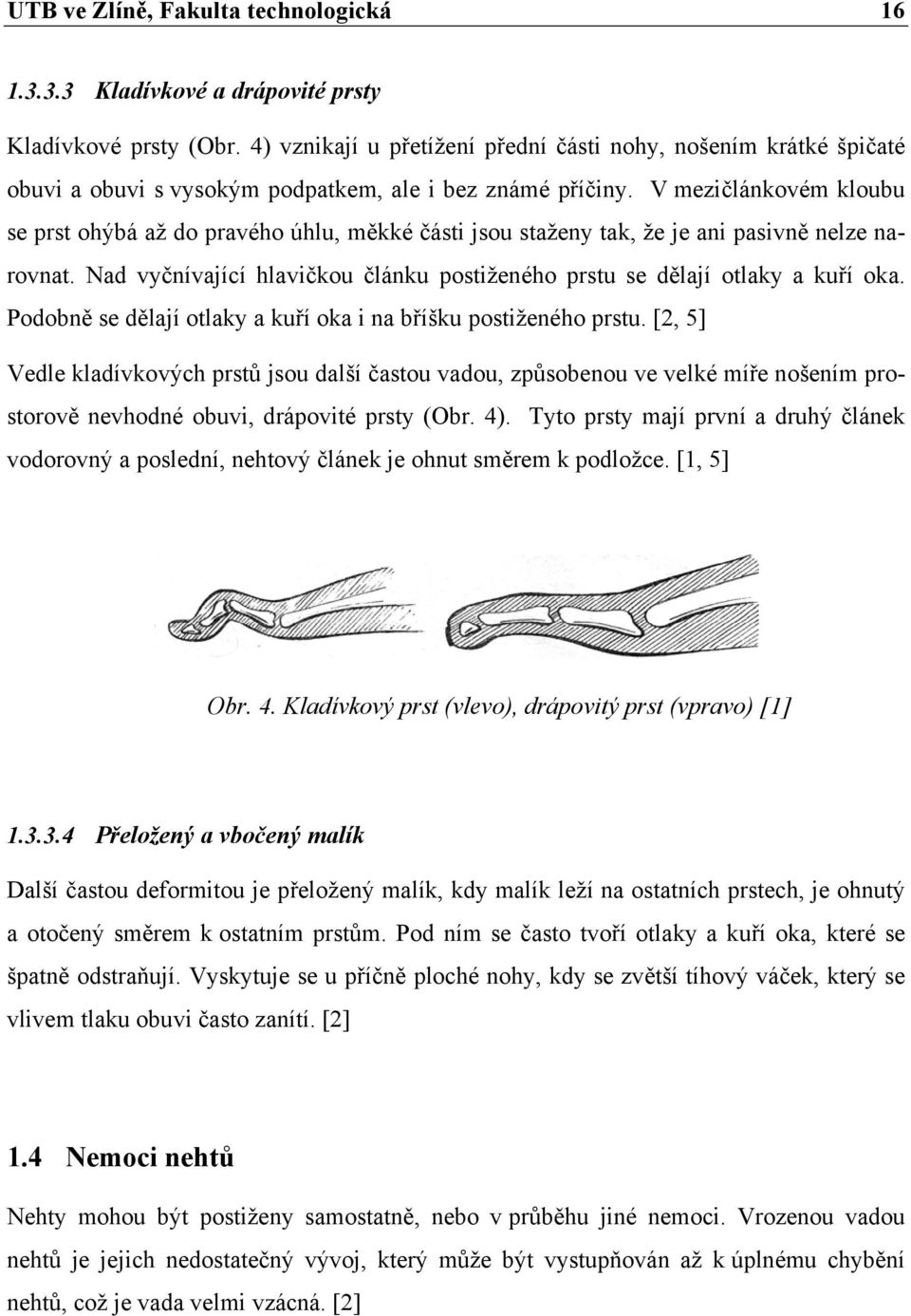 V mezičlánkovém kloubu se prst ohýbá až do pravého úhlu, měkké části jsou staženy tak, že je ani pasivně nelze narovnat. Nad vyčnívající hlavičkou článku postiženého prstu se dělají otlaky a kuří oka.