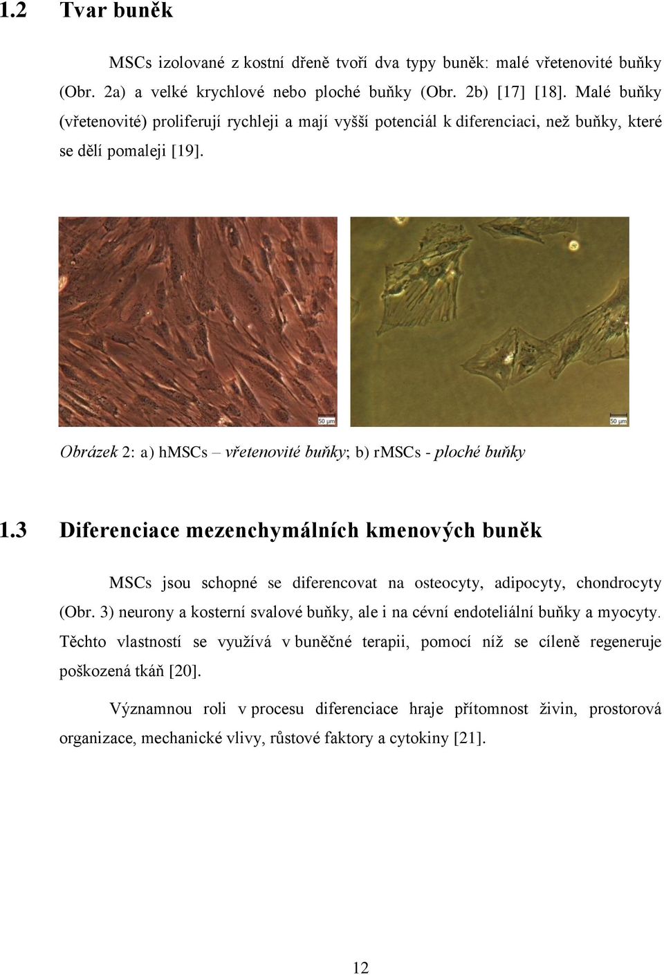 3 Diferenciace mezenchymálních kmenových buněk MSCs jsou schopné se diferencovat na osteocyty, adipocyty, chondrocyty (Obr.
