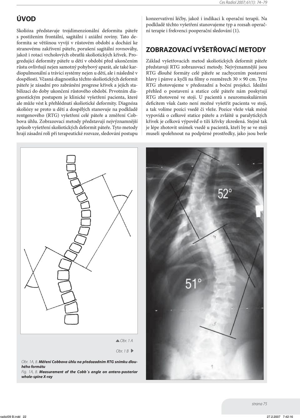 Progredující deformity páteře u dětí v období před ukončením růstu ovlivňují nejen samotný pohybový aparát, ale také kardiopulmonální a trávicí systémy nejen u dětí, ale i následně v dospělosti.