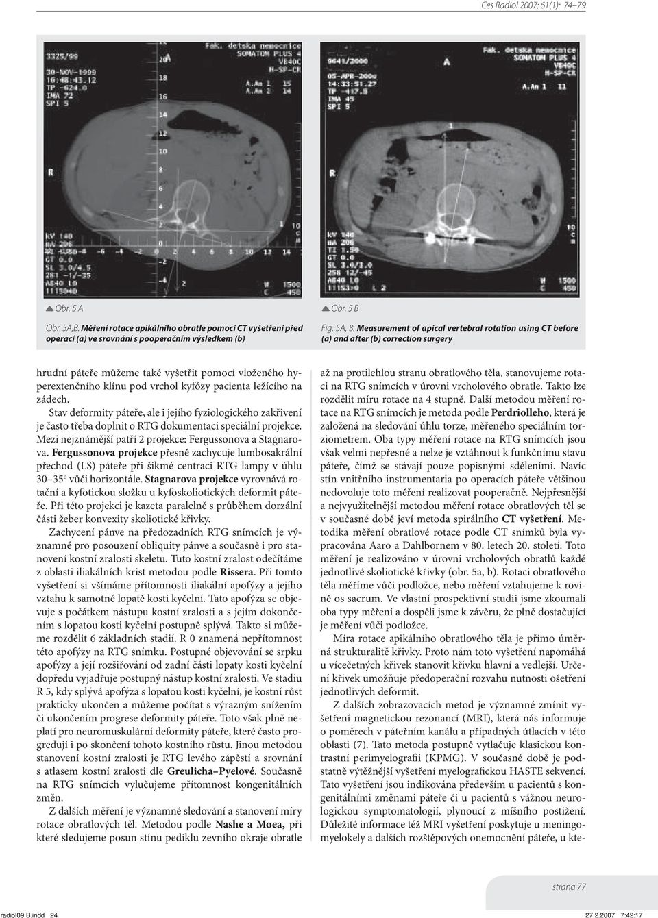 ležícího na zádech. Stav deformity páteře, ale i jejího fyziologického zakřivení je často třeba doplnit o RTG dokumentaci speciální projekce.