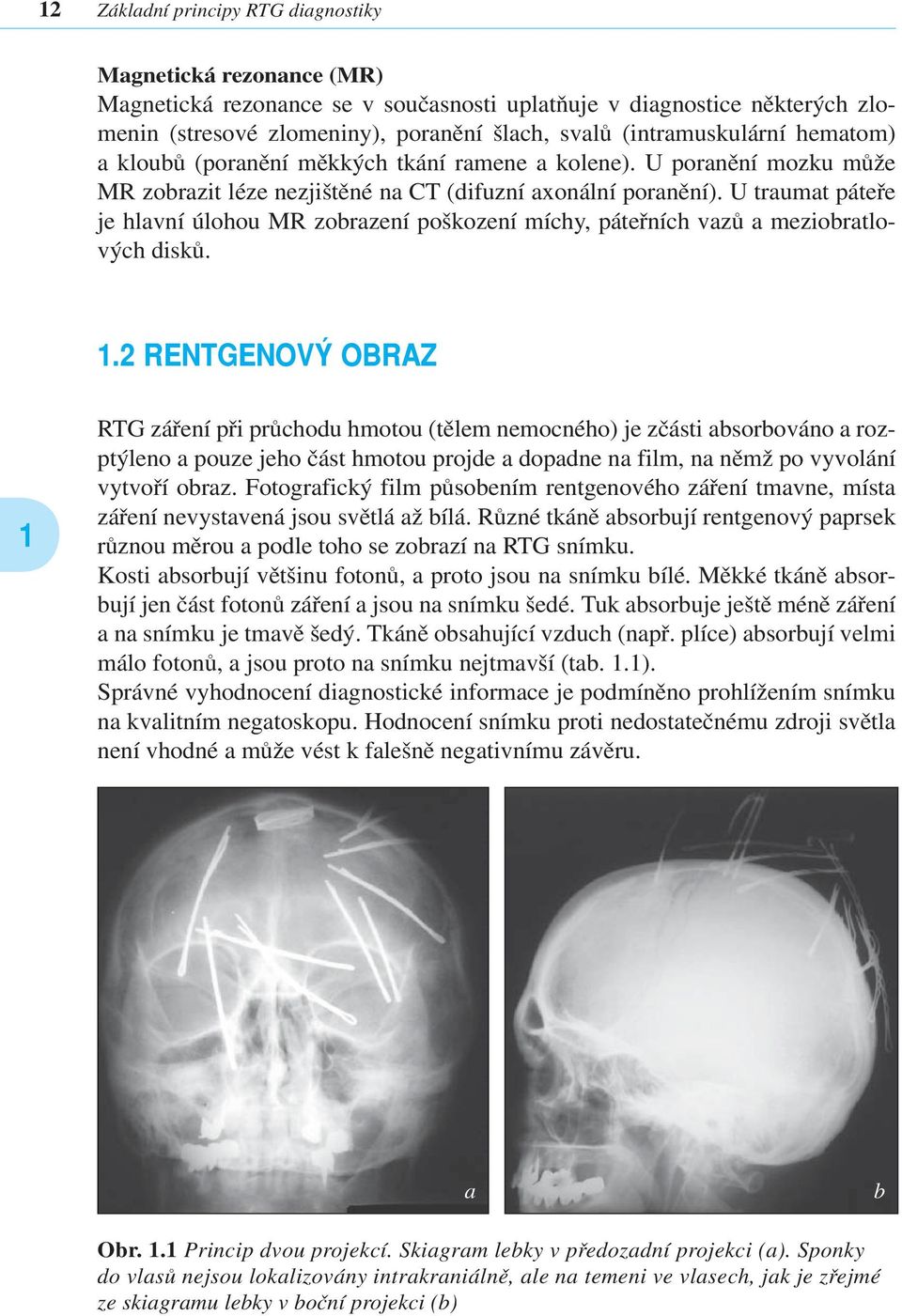 U traumat páteře je hlavní úlohou MR zobrazení poškození míchy, páteřních vazů a meziobratlových disků. 1.