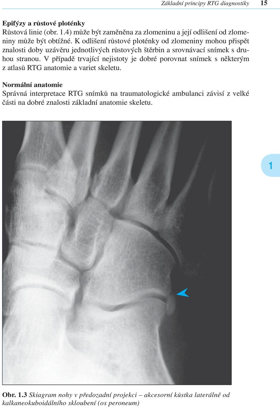 V případě trvající nejistoty je dobré porovnat snímek s některým z atlasů RTG anatomie a variet skeletu.