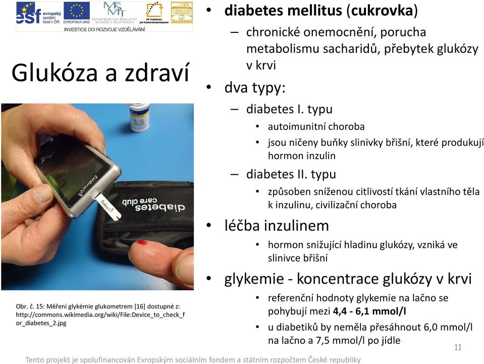 typu autoimunitní choroba jsou ničeny buňky slinivky břišní, které produkují hormon inzulin diabetes II.