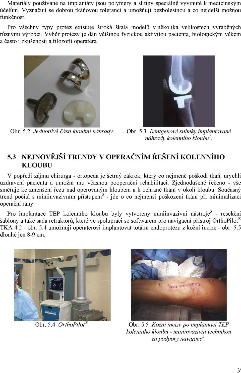 Výběr protézy je dán většinou fyzickou aktivitou pacienta, biologickým věkem a často i zkušeností a filozofií operatéra. Obr. 5.2 Jednotlivé části kloubní náhrady. Obr. 5.3 Rentgenové snímky implantované náhrady kolenního kloubu 2.