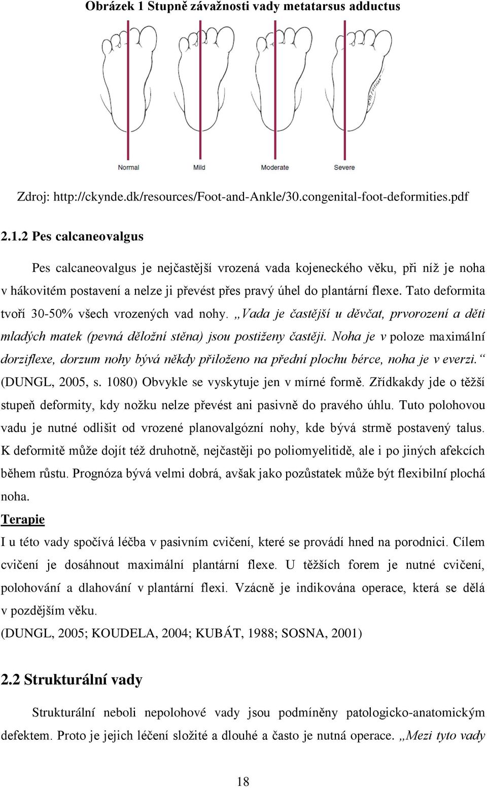 Noha je v poloze maximální dorziflexe, dorzum nohy bývá někdy přiloženo na přední plochu bérce, noha je v everzi. (DUNGL, 2005, s. 1080) Obvykle se vyskytuje jen v mírné formě.