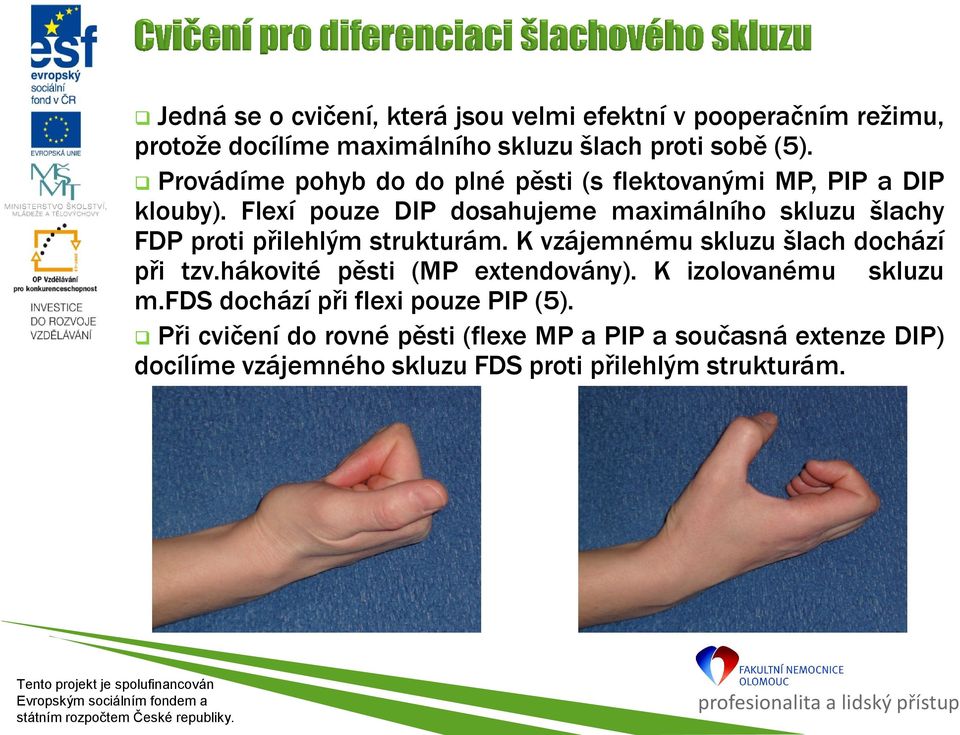 Flexí pouze DIP dosahujeme maximálního skluzu šlachy FDP proti přilehlým strukturám. K vzájemnému skluzu šlach dochází při tzv.