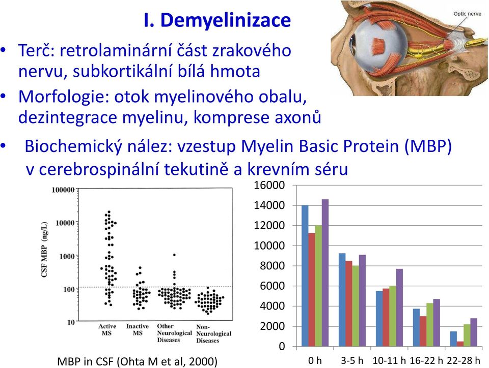 vzestup Myelin Basic Protein (MBP) v cerebrospinální tekutině a krevním séru MBP in CSF