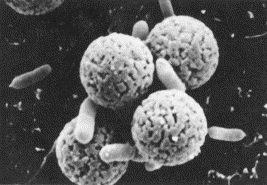 Buňky Escherichia coli O157 vázané na Dynabeads M280 Extrémně nízká