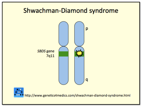 PORUCHY TVORBY RIBOSOMŮ Shwachman Diamondův syndrom pancytopenie se známkami selhání kostní dřeně a rozvojem