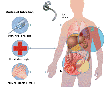 Ebola