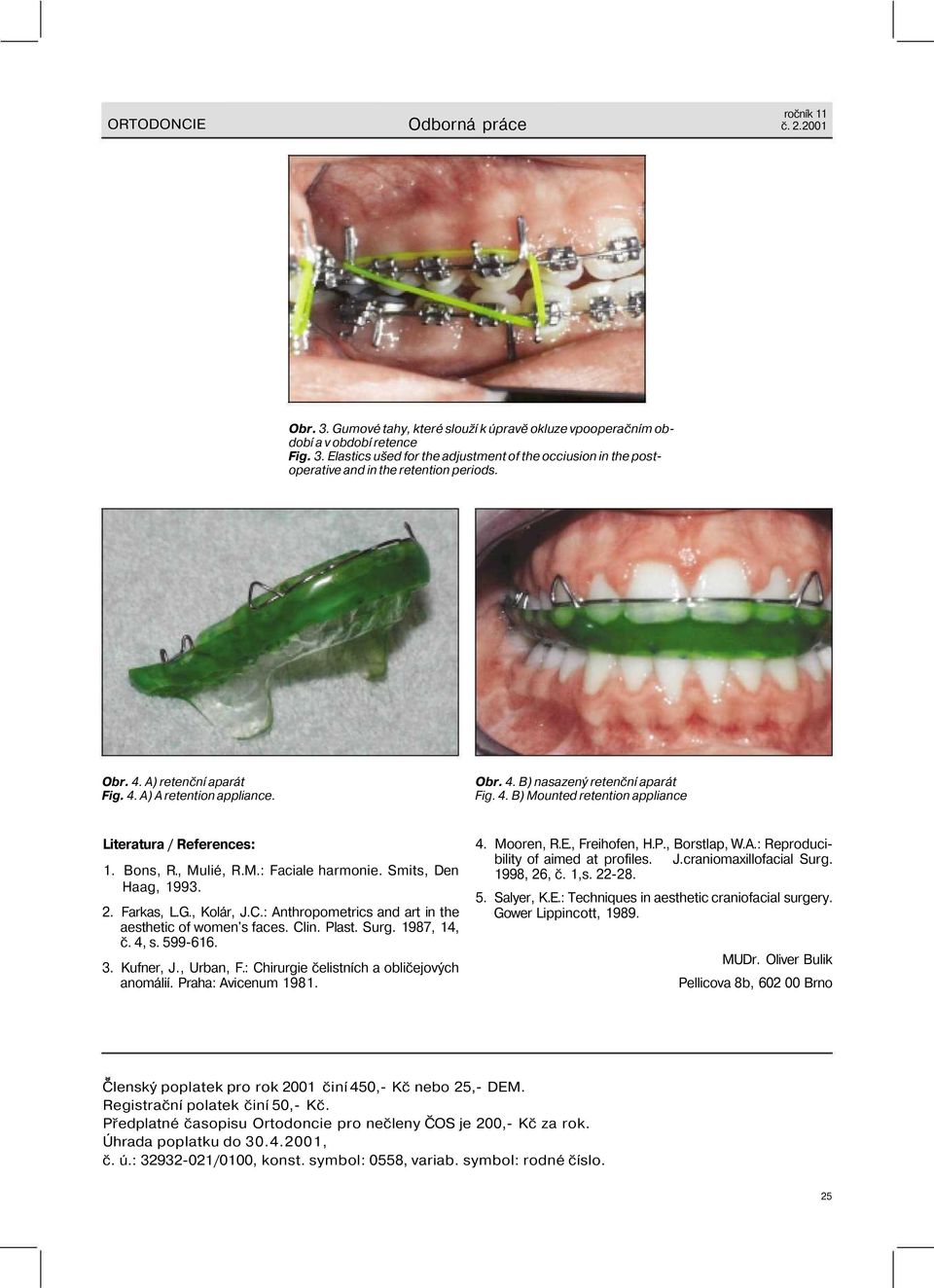 Smits, Den Haag, 1993. 2. Farkas, L.G., Kolár, J.C.: Anthropometrics and art in the aesthetic of women's faces. Clin. Plast. Surg. 1987, 14, č. 4, s. 599-616. 3. Kufner, J., Urban, F.