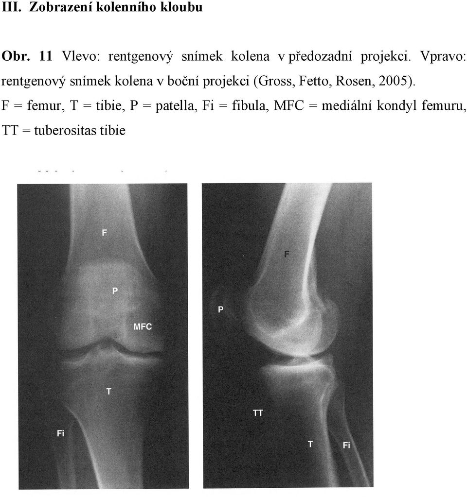 Vpravo: rentgenový snímek kolena v boční projekci (Gross, Fetto,