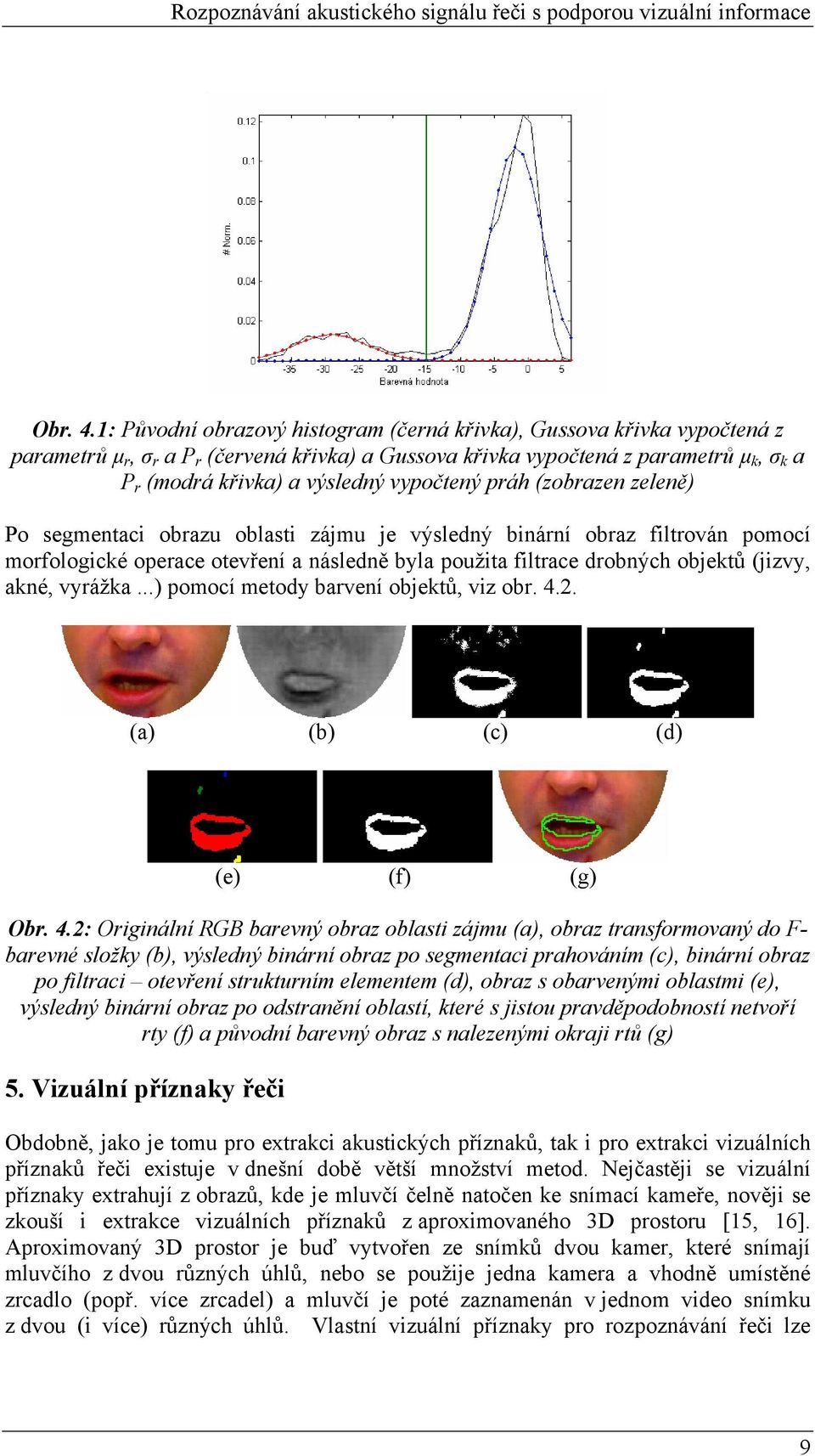 vypočtený práh (zobrazen zeleně) Po segmentaci obrazu oblasti zájmu je výsledný binární obraz filtrován pomocí morfologické operace otevření a následně byla použita filtrace drobných objektů (jizvy,