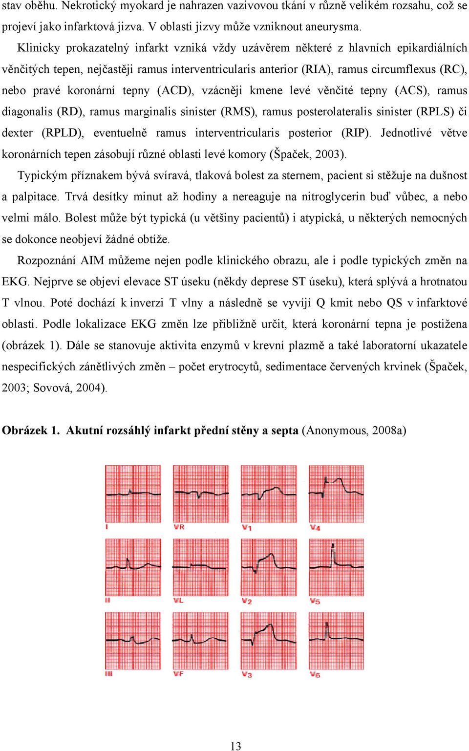 tepny (ACD), vzácněji kmene levé věnčité tepny (ACS), ramus diagonalis (RD), ramus marginalis sinister (RMS), ramus posterolateralis sinister (RPLS) či dexter (RPLD), eventuelně ramus