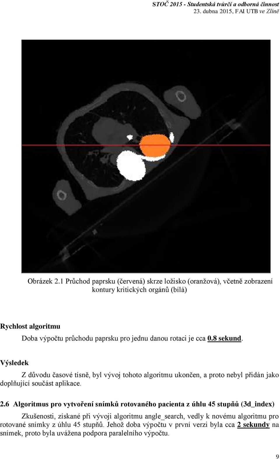 jednu danou rotaci je cca 0.8 sekund. Výsledek Z důvodu časové tísně, byl vývoj tohoto algoritmu ukončen, a proto nebyl přidán jako doplňující součást aplikace.