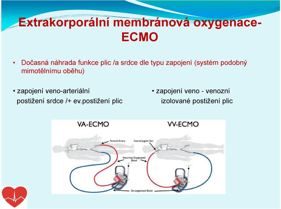 mimotělnímu oběhu) zapojení veno-arteriální zapojení veno -