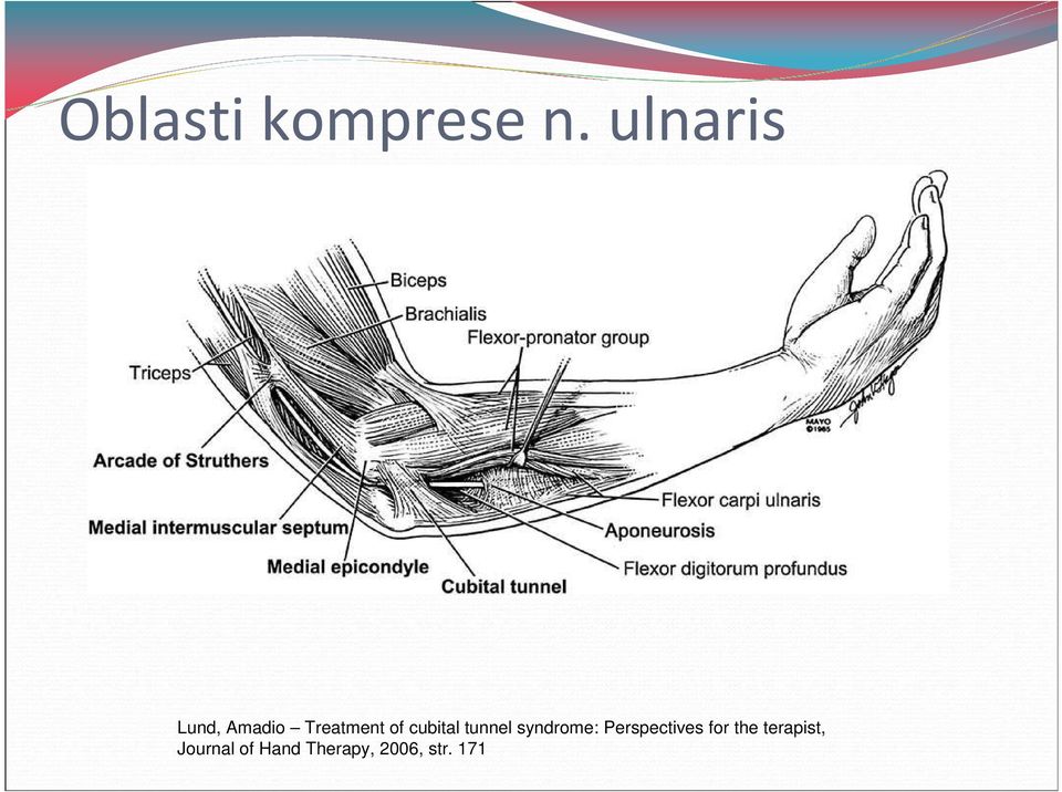 cubital tunnel syndrome: Perspectives