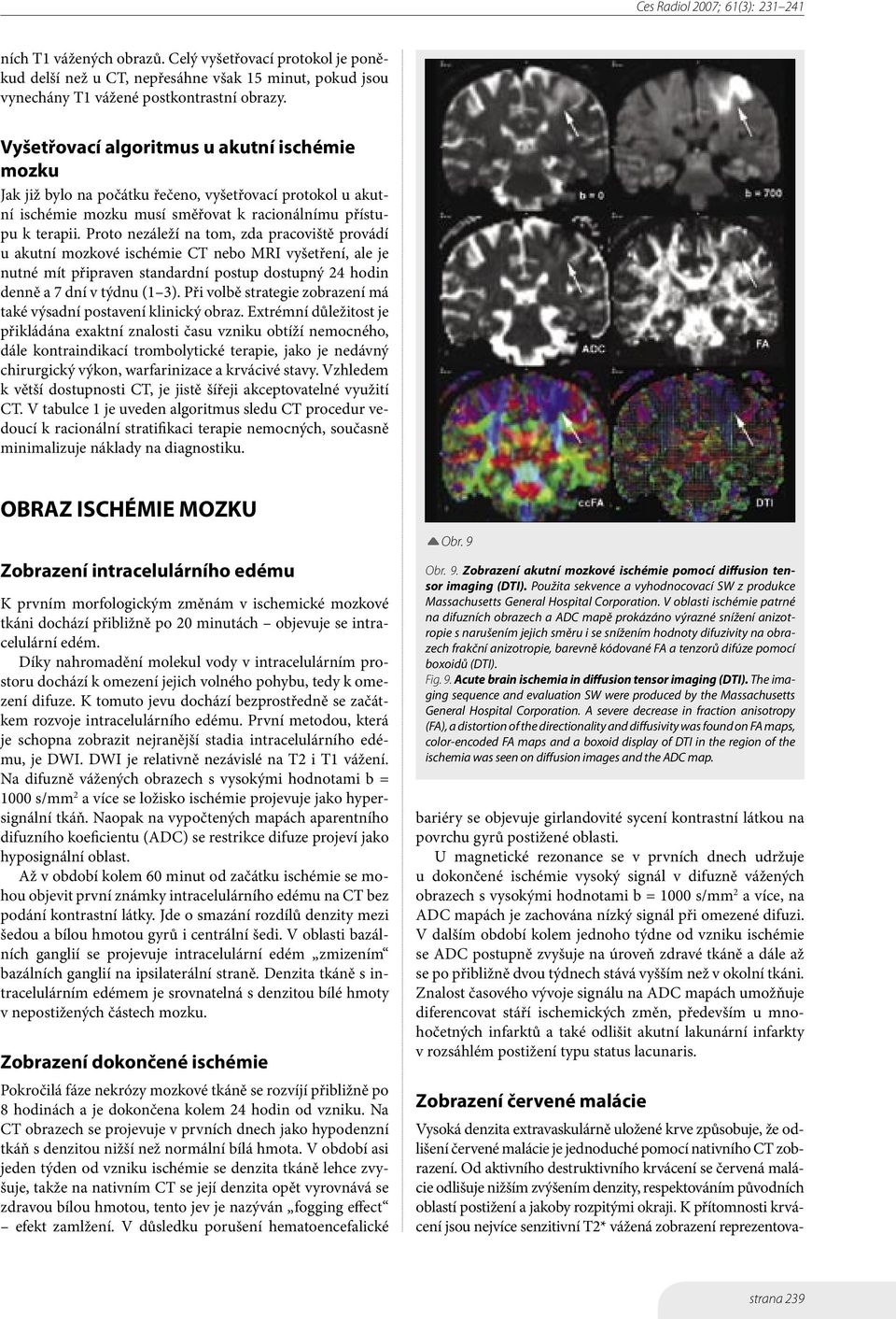 Proto nezáleží na tom, zda pracoviště provádí u akutní mozkové ischémie CT nebo MRI vyšetření, ale je nutné mít připraven standardní postup dostupný 24 hodin denně a 7 dní v týdnu (1 3).