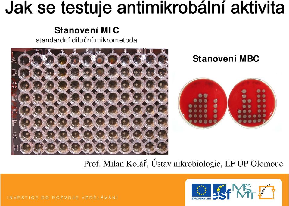 diluční mikrometoda Stanovení MBC